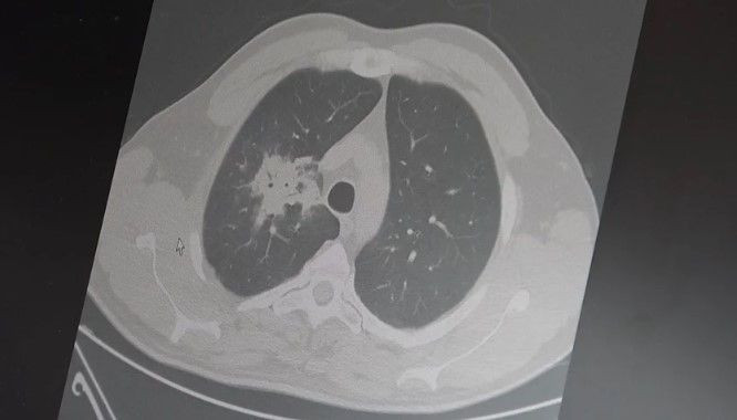 Elektronik sigara kullananlar dikkat: 20 yıllık süre doldu, korkunç gerçekler ortaya çıktı - Resim: 3