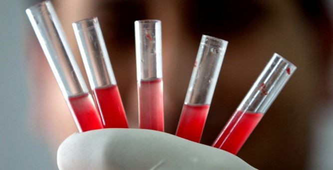 En güçlü bağışıklık hangi kan grubunda? Gerçekler şaşırtıyor - Resim: 7