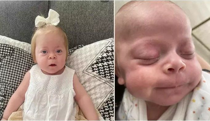 Hastalığın taşıyıcısı anne ve baba çıktı: 'Tanıyı duyunca dünyam başıma yıkıldı' - Resim: 1