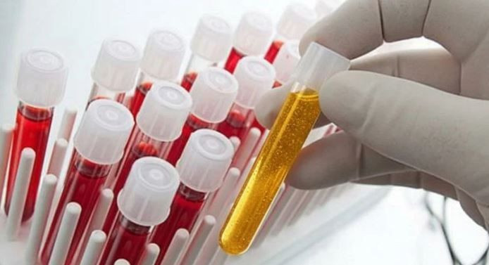 En güçlü bağışıklık hangi kan grubunda? Gerçekler şaşırtıyor - Resim: 6