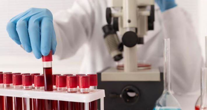 En güçlü bağışıklık hangi kan grubunda? Gerçekler şaşırtıyor - Resim: 1