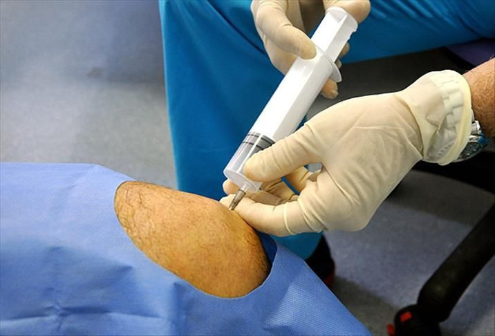 Diziniz neden acıyor? İşte en sık karşılaşılan 5 tehlikeli sebep - Resim: 3