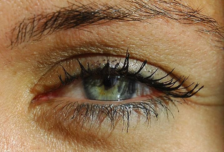 Bu hastalık sessizce ilerliyor, teşhis gecikirse kör ediyor: Uzmanlar uyardı - Resim: 4