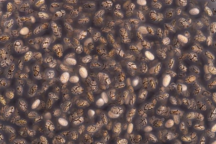 Gençlerde kolon kanseri alarmı: Neden artıyor? İşte bağırsakların en iyi dostları - Resim: 12