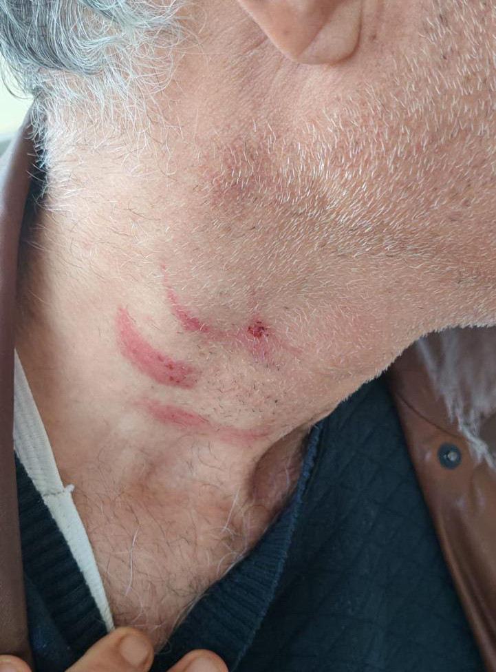 Sağlık merkezinde dehşet: Doktoru darbeden müezzin tutuklandı - Resim : 1