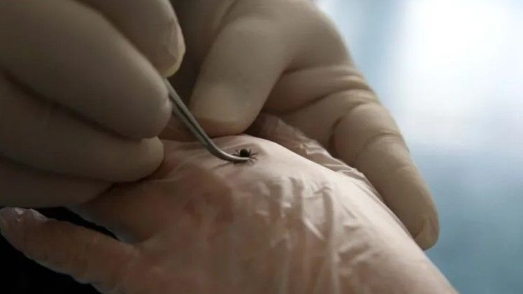 Bir ısırıkla başı döndü iştahtan kesildi: 15 gün sonra hayatını kaybetti - Resim: 11