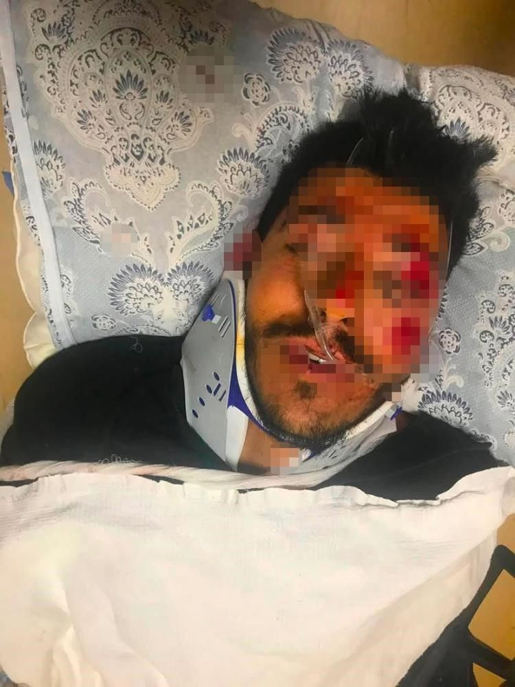 Alkol şişede durduğu gibi durmadı: Sahilde oturanlar saniyeler içinde felaketi yaşadı - Resim: 7