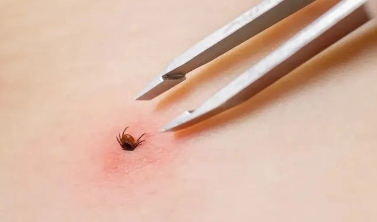 Bir kenti korkutan olay: 5 kişi aynı nedenden hayatını kaybetti - Resim: 3