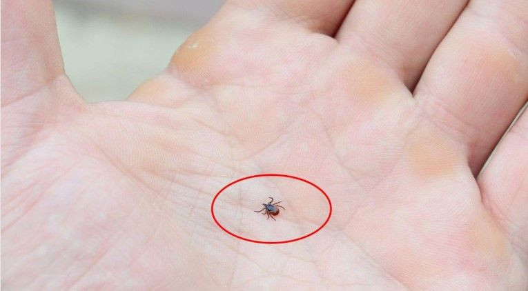 Bir ısırıkla başı döndü iştahtan kesildi: 15 gün sonra hayatını kaybetti - Resim: 7