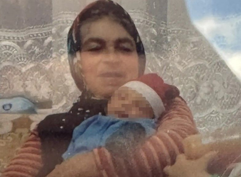 Bir ısırıkla başı döndü iştahtan kesildi: 15 gün sonra hayatını kaybetti - Resim: 5
