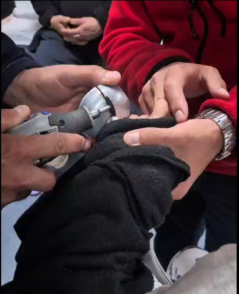 Bu operasyonda doktorlar çaresiz kaldı: İtfaiye ekibi çağırdılar: Amasya'da korku dolu anlar - Resim : 2