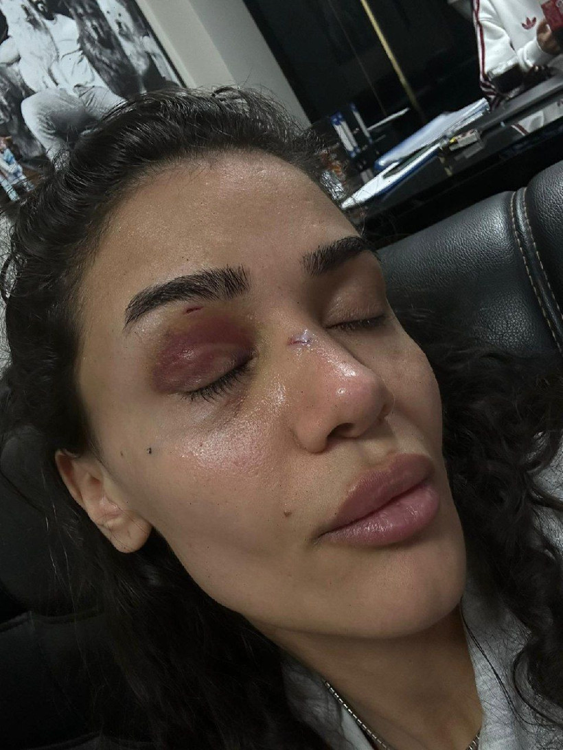 Hemşire Ebru’nun feryadı: Ölmek istemiyorum, sesimi duyun - Resim: 6