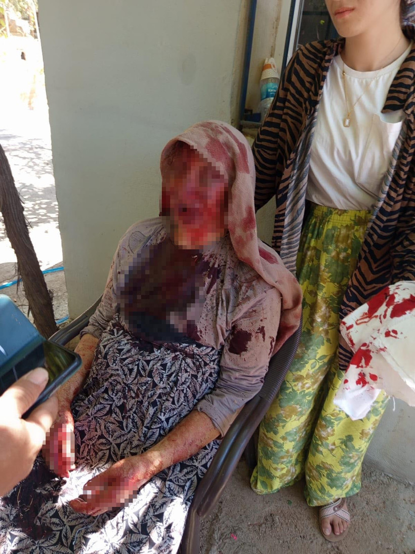 Eşini öldüren katil bu kez 85 yaşındaki annesini sopa ile dövdü - Resim : 2