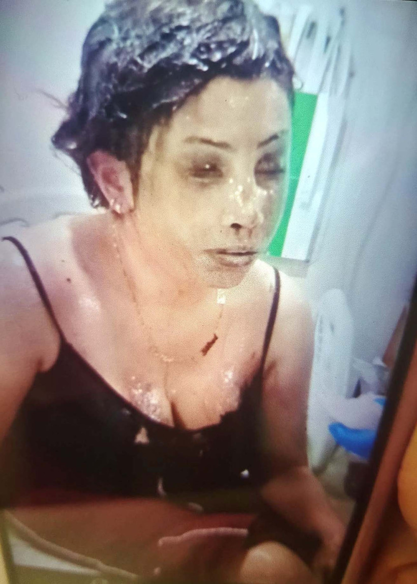 İşkenceci cani adam: Kadına vahşette sınır tanımadı - Resim : 5