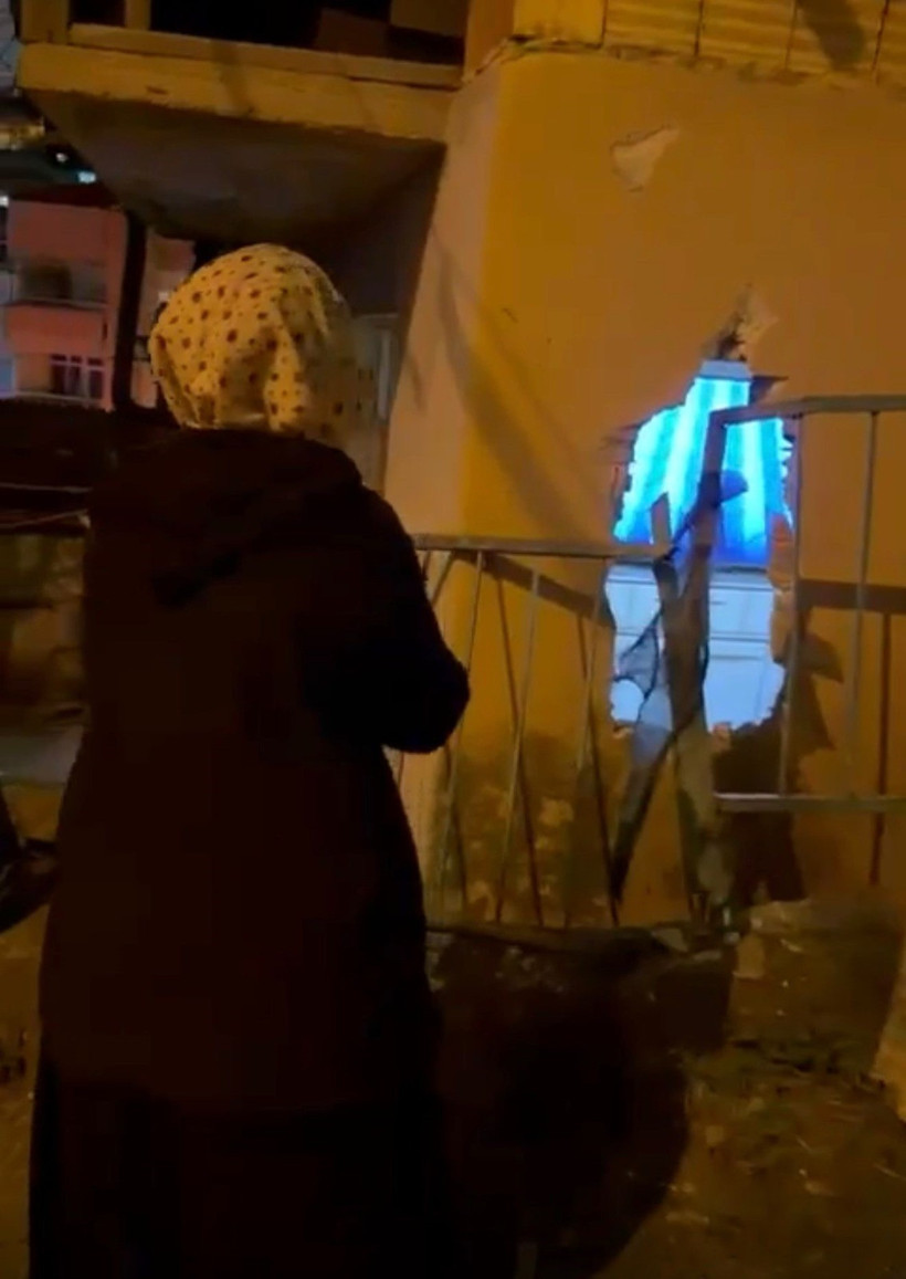 Talihsizliğin b&ouml;ylesi... Evinde otururken kazada yaralandı - Resim : 1