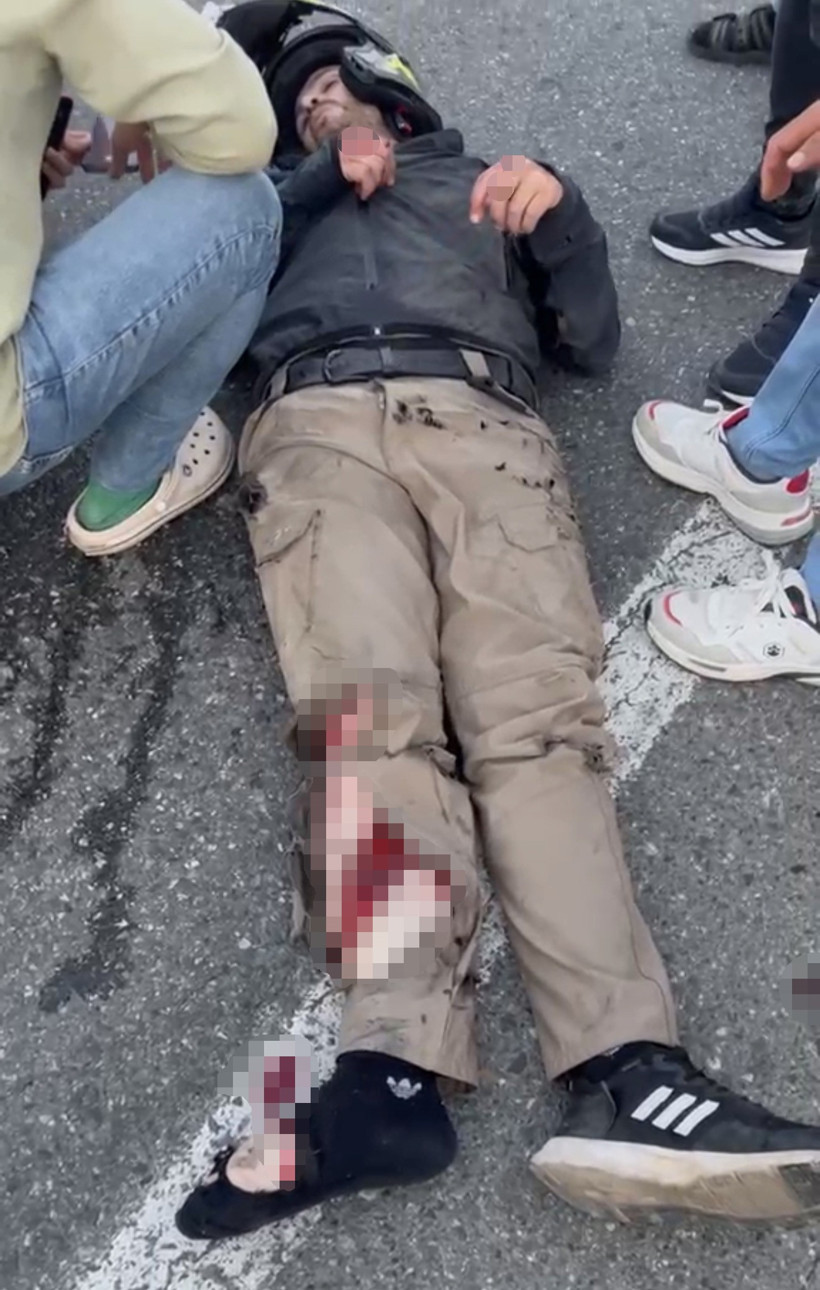 Virajı alamayan motosiklet bariyerlere çarptı: 2 kişi ağır yaralandı - Resim : 1