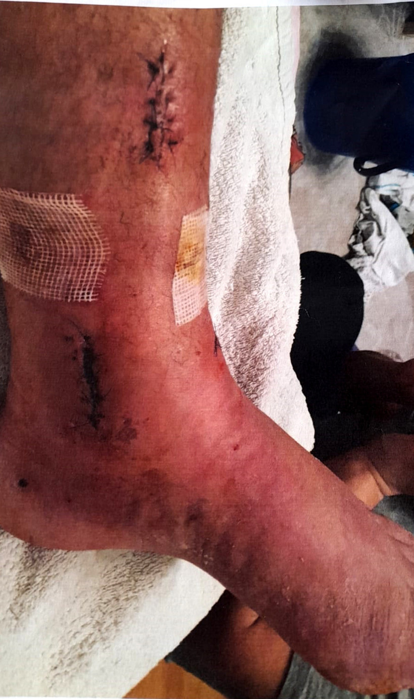 İki metrelik ihmale 1 milyon liralık fatura: Gurbetçinin yılbaşı tatili kabusa dönmüştü - Resim : 4