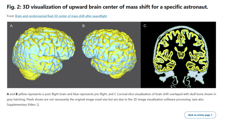 Astronotların v&uuml;cudundaki değişim ortaya &ccedil;ıktı: Bilim insanları nedenleriyle a&ccedil;ıkladı - Resim : 5