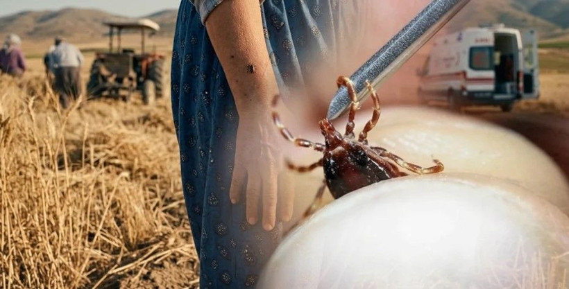 Bir ısırıkla başı döndü iştahtan kesildi: 15 gün sonra hayatını kaybetti - Resim: 9