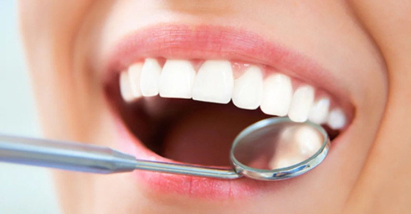 Diş implantı yaptıracaklar dikkat... Riski artıran neden ortaya çıktı - Resim: 5