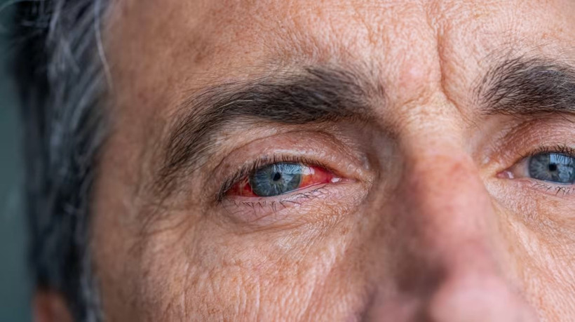 Bu hastalık sessizce ilerliyor, teşhis gecikirse kör ediyor: Uzmanlar uyardı - Resim: 15