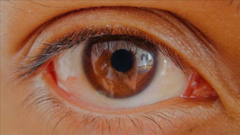 Bu hastalık sessizce ilerliyor, teşhis gecikirse kör ediyor: Uzmanlar uyardı - Resim: 7