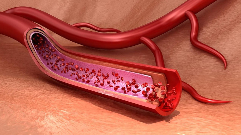 Her yemekten sonra uyukluyor musunuz? İnsülin direncinin 10 gizli belirtisi - Resim: 3