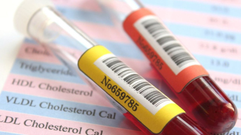 Her yemekten sonra uyukluyor musunuz? İnsülin direncinin 10 gizli belirtisi - Resim: 7