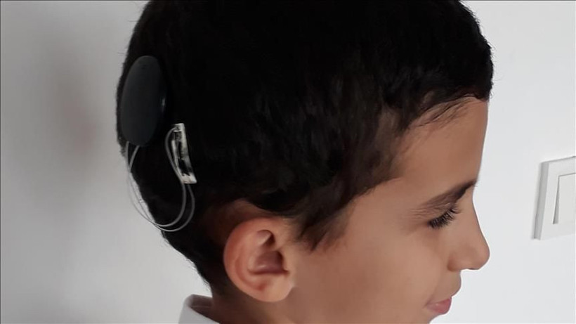 Mahkemeden SGK’ya karşı emsal karar... İşitme cihazı ücretinin tamamı ödenecek - Resim: 1