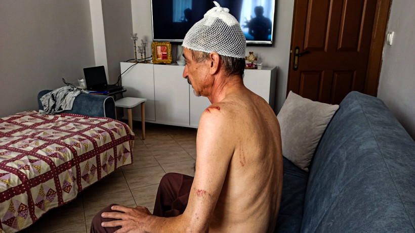 Gökyüzünden ölüm yağdı: Çay keyfi hastanede bitti: Başına 11 dikiş atıldı - Resim : 5