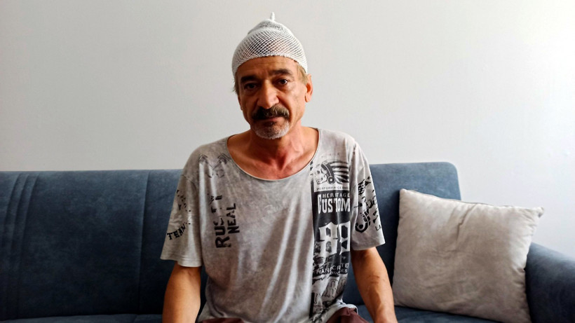 Gökyüzünden ölüm yağdı: Çay keyfi hastanede bitti: Başına 11 dikiş atıldı - Resim : 4