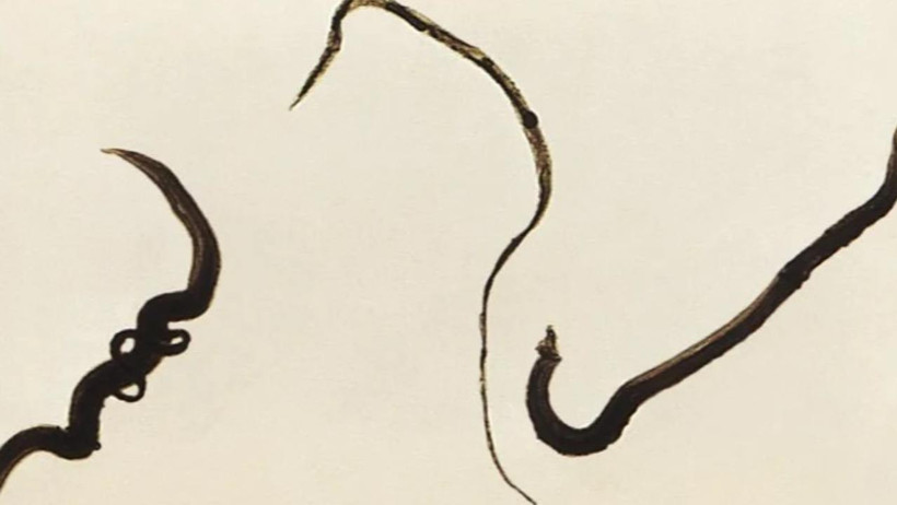 DS&Ouml;&rsquo;den k&uuml;resel uyarı: Cinsel organlara yerleşen parazit yeni &uuml;lkelere yayılabilir - Resim : 1