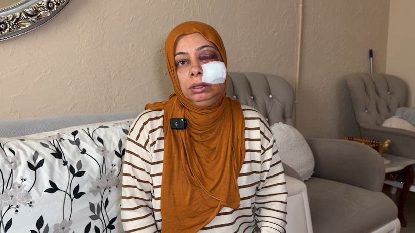 Hatay'da kırık rögar kapağına düştü ölümden döndü: Şükriye'nin yüzüne tam 14 dikiş atıldı - Resim : 2