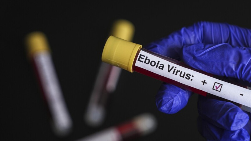 Fransa'da Ebola alarmı: İlk vaka tespit edildi - Resim : 2