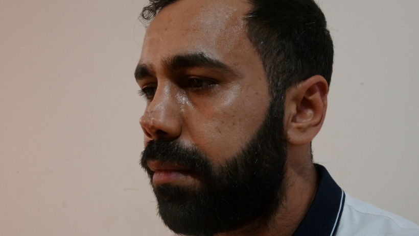 Burun ameliyatı hayatını kararttı: 2,2 milyon liralık masraf çıktı - Resim: 3