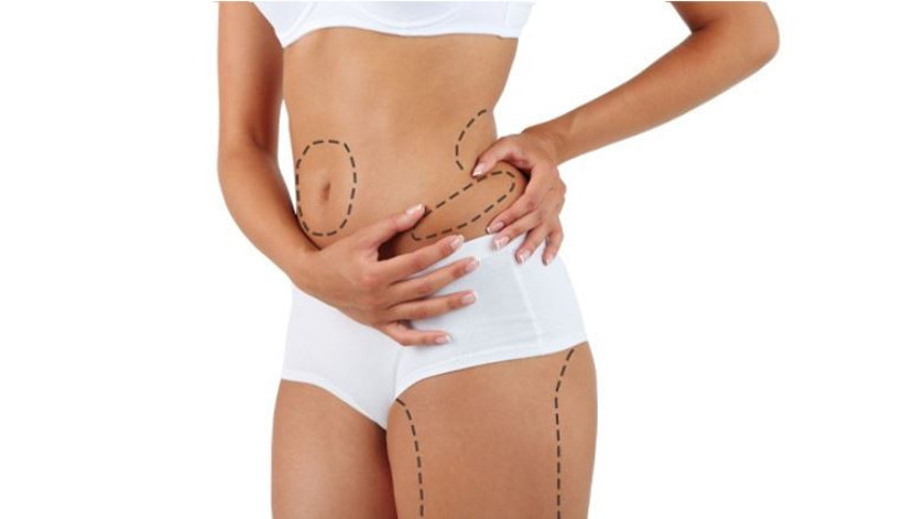 Karın germe ameliyatı nedir? Abdominoplasti hakkında merak ettikleriniz - Resim : 1