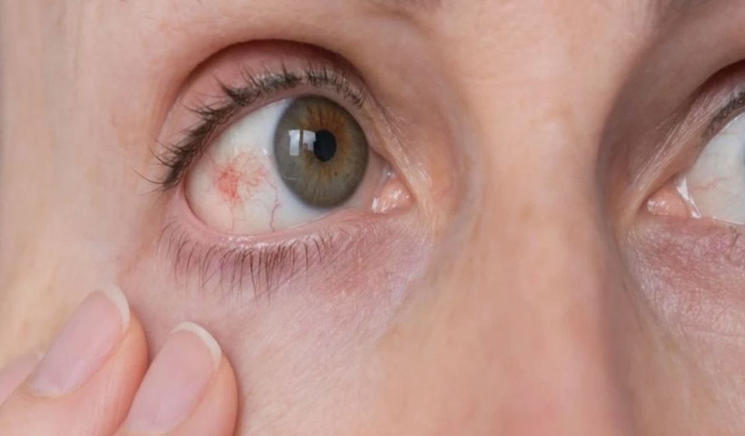 Bu hastalık sessizce ilerliyor, teşhis gecikirse kör ediyor: Uzmanlar uyardı - Resim: 10