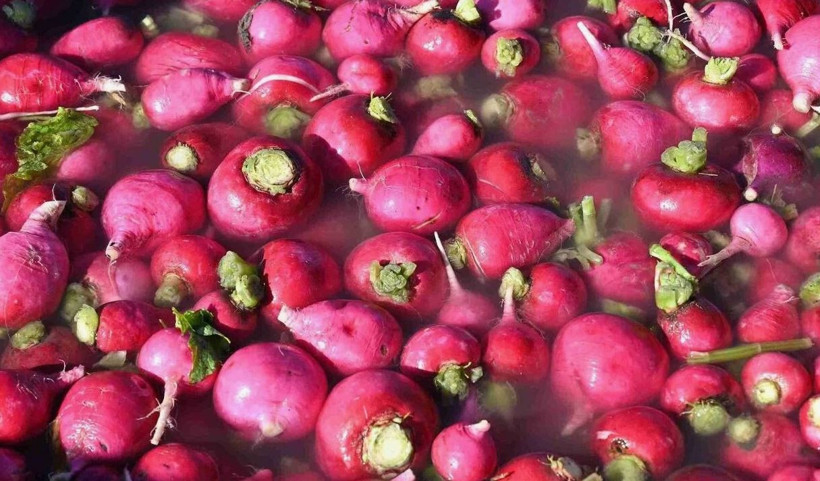 Gençlerde kolon kanseri alarmı: Neden artıyor? İşte bağırsakların en iyi dostları - Resim: 22