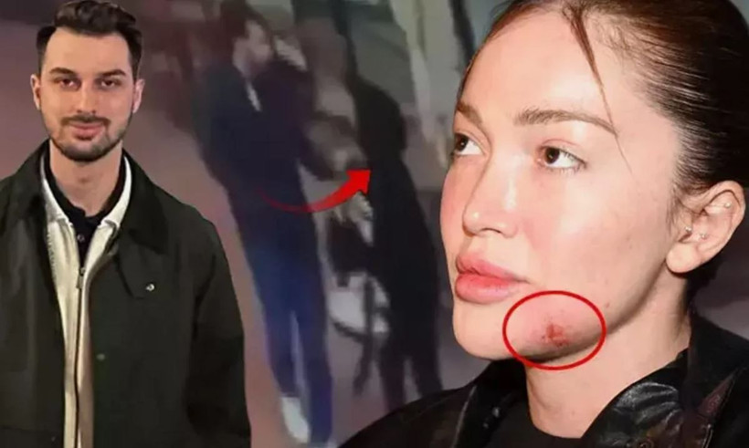 2025 böyle geçti: Kimler ayrıldı, kimler kayboldu? İşte Türkiye’de ve Dünya’da yılın magazin olayları - Resim: 20