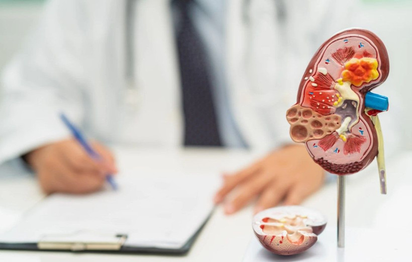 Böbrek sağlığı için 8 altın kural: Uzmanlar tek tek sıraladı - Resim: 4