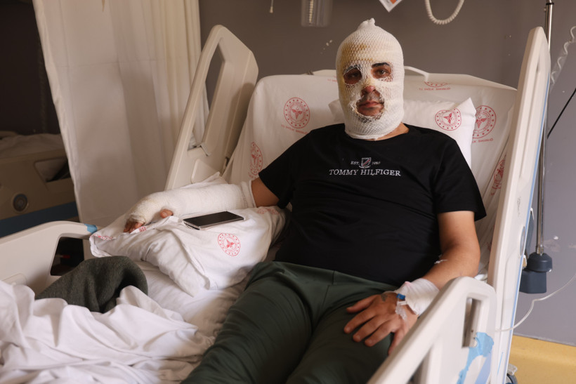 Ekmek teknesi küle döndü, kendisi alevler içinde kaldı - Resim : 1
