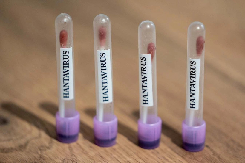 Hantavirüs nedir? Hangi ülkelerde görülüyor, Türkiye’de var mı, tedavisi var mı? - Resim: 3