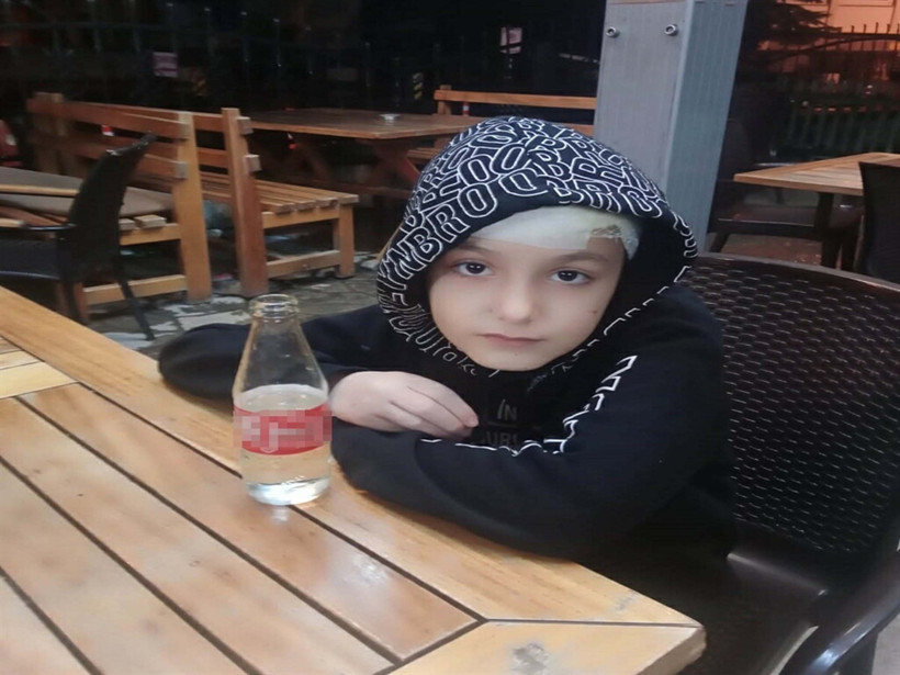 Mahkemeden tarihi karar: Üç kurum 5 milyon ödeyecek: Tunahan sokak köpeklerin saldırısına uğramıştı - Resim : 4