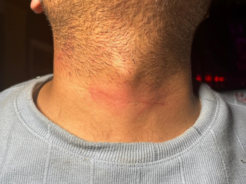Siren sesleri yerini yumruklara bıraktı: Önce önünü kesti, sonra saldırdı - Resim: 10