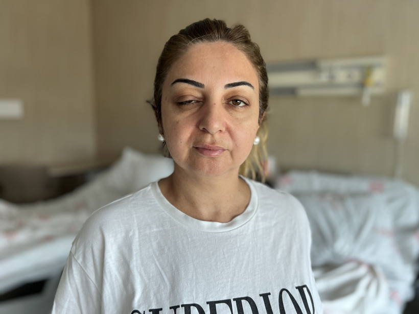 “Migrene iyi gelecek dediler”: Botoks sonrası hayatları kabusa döndü - Resim : 4