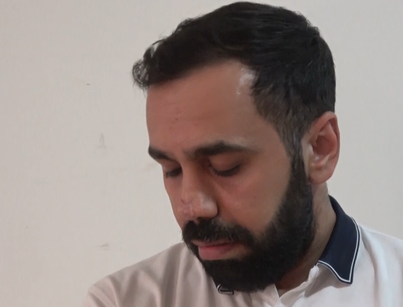 Burun ameliyatı hayatını kararttı: 2,2 milyon liralık masraf çıktı - Resim: 11