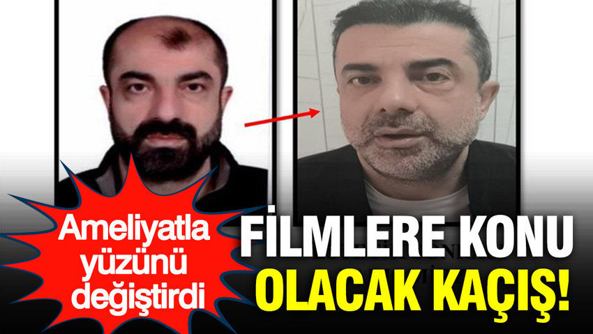 Filmlere konu olacak kaçış: Ameliyatla yüzünü değiştirdi