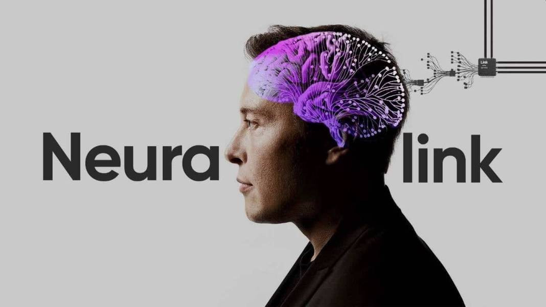 Elon Musk'un projesi Neuralink nedir? Neuralink ne işe yarayacak