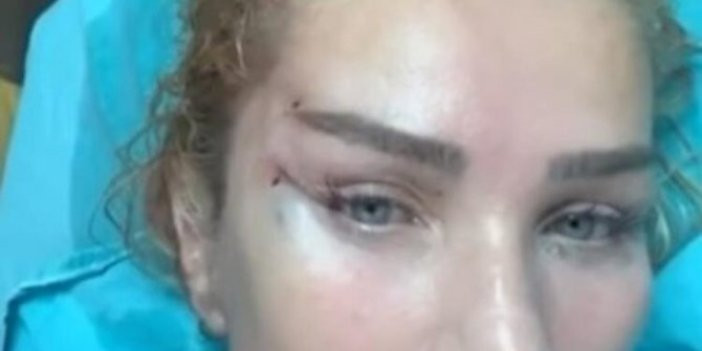 57 yaşındaki Seda Sayan yüzüne Fransız askısı yaptırdı