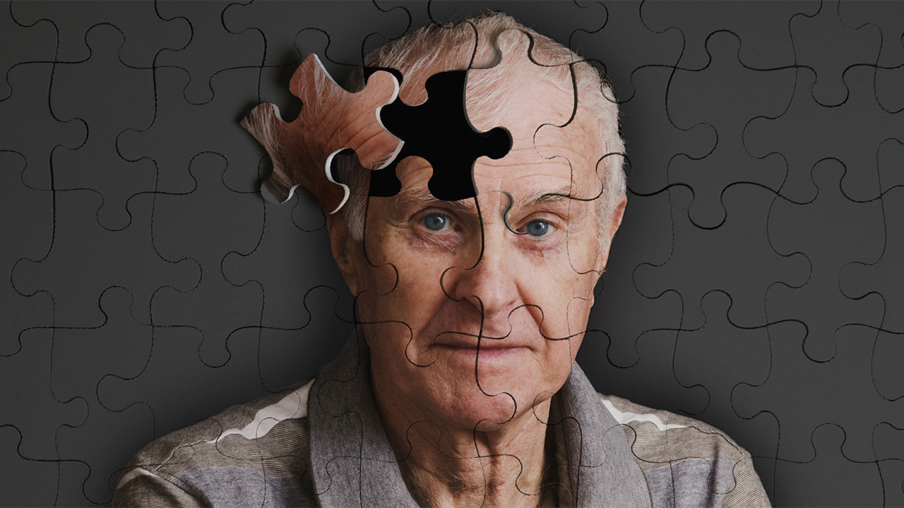 kimler-alzheimer-hastaligi-icin-risk-tasiyor.jpg